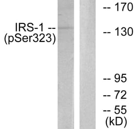 Western Blot - Anti-IRS-1 (phospho Ser323) Antibody (A0497) - Antibodies.com