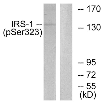 Western Blot - Anti-IRS-1 (phospho Ser323) Antibody (A0497) - Antibodies.com