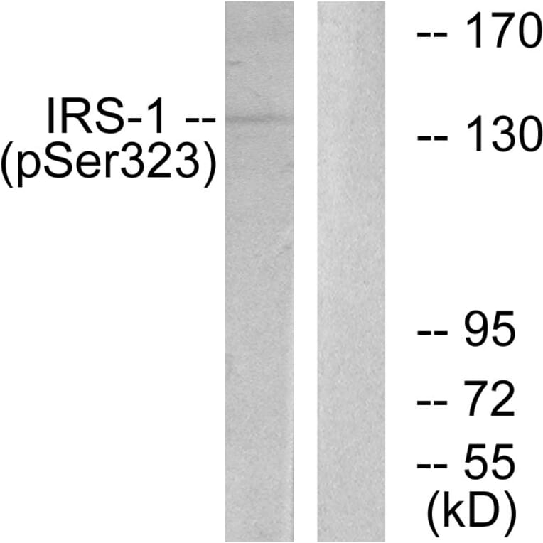 Western Blot - Anti-IRS-1 (phospho Ser323) Antibody (A0497) - Antibodies.com