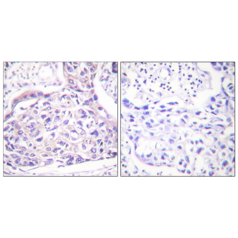 Immunohistochemistry - Anti-IRS-1 (phospho Ser323) Antibody (A0497) - Antibodies.com