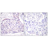 Immunohistochemistry - Anti-IRS-1 (phospho Ser323) Antibody (A0497) - Antibodies.com