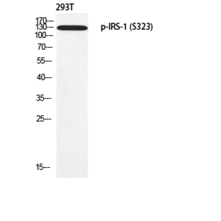 Western Blot - Anti-IRS-1 (phospho Ser323) Antibody (A0497) - Antibodies.com