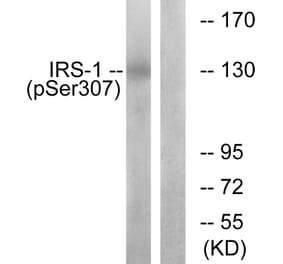 Western Blot - Anti-IRS-1 (phospho Ser307) Antibody (A7120) - Antibodies.com