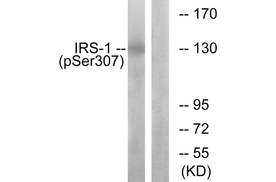 Western Blot - Anti-IRS-1 (phospho Ser307) Antibody (A7120) - Antibodies.com
