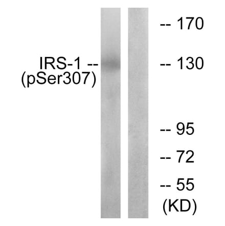 Western Blot - Anti-IRS-1 (phospho Ser307) Antibody (A7120) - Antibodies.com
