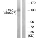 Western Blot - Anti-IRS-1 (phospho Ser307) Antibody (A7120) - Antibodies.com