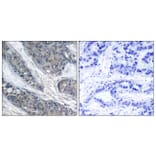 Immunohistochemistry - Anti-IRS-1 (phospho Ser307) Antibody (A7120) - Antibodies.com