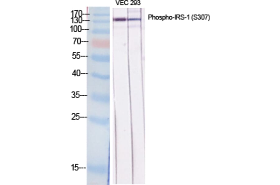 Western Blot - Anti-IRS-1 (phospho Ser307) Antibody (A7120) - Antibodies.com