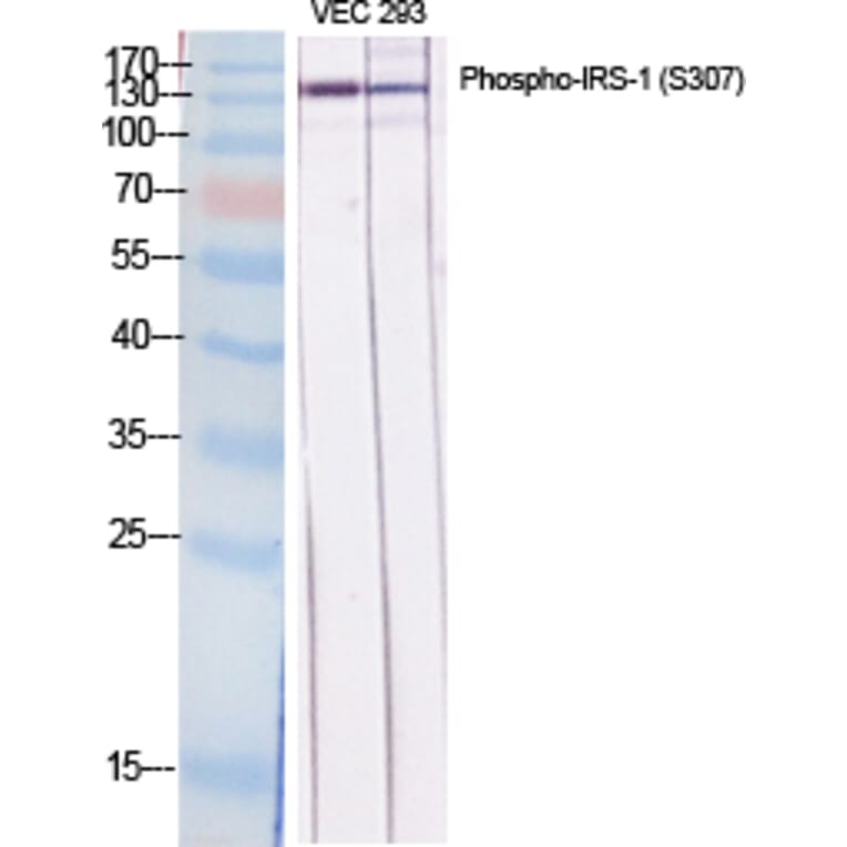 Western Blot - Anti-IRS-1 (phospho Ser307) Antibody (A7120) - Antibodies.com