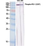 Western Blot - Anti-IRS-1 (phospho Ser307) Antibody (A7120) - Antibodies.com