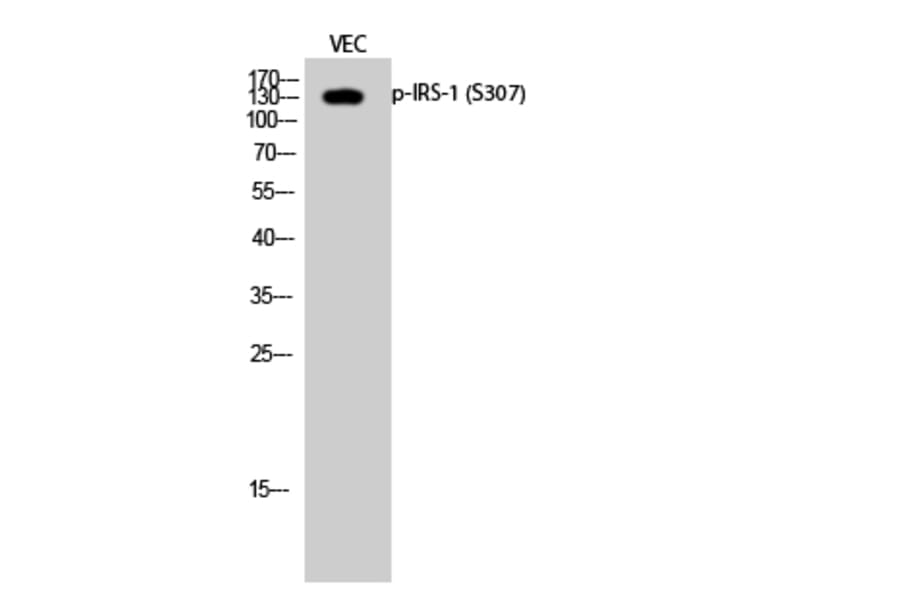 Western Blot - Anti-IRS-1 (phospho Ser307) Antibody (A7120) - Antibodies.com