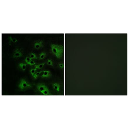 Immunofluorescence - Anti-HER4 (phospho Tyr1284) Antibody (A0947) - Antibodies.com