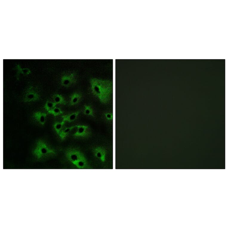 Immunofluorescence - Anti-HER4 (phospho Tyr1284) Antibody (A0947) - Antibodies.com