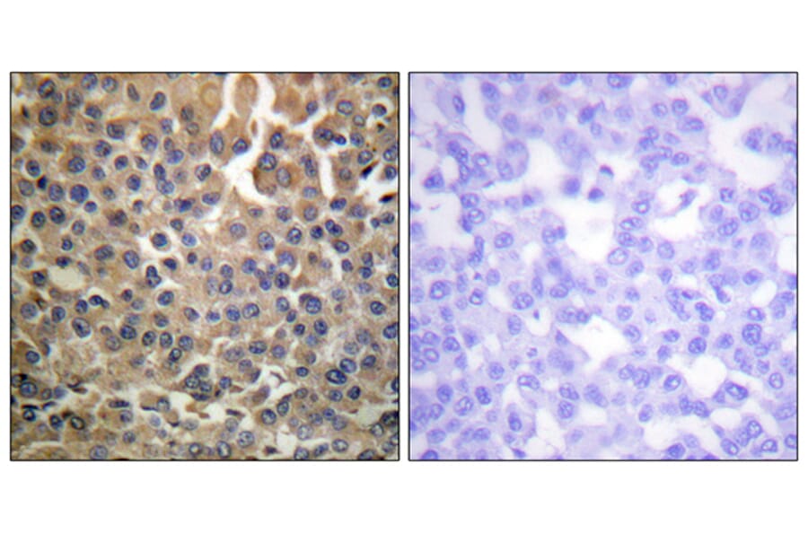 Immunohistochemistry - Anti-HER4 (phospho Tyr1284) Antibody (A0947) - Antibodies.com