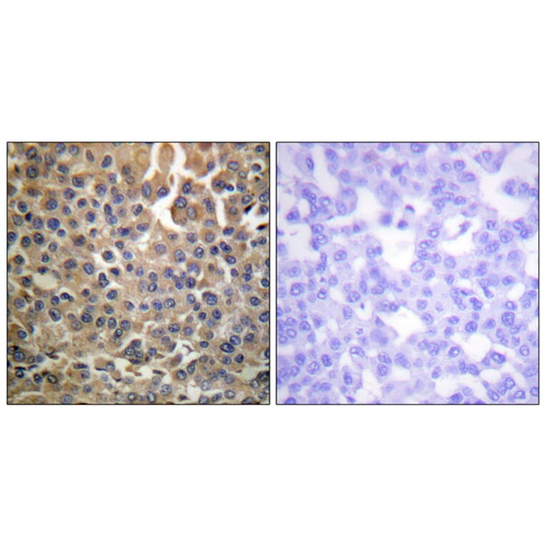 Immunohistochemistry - Anti-HER4 (phospho Tyr1284) Antibody (A0947) - Antibodies.com