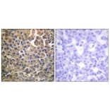 Immunohistochemistry - Anti-HER4 (phospho Tyr1284) Antibody (A0947) - Antibodies.com