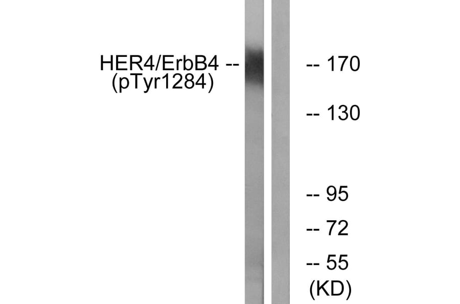 Western Blot - Anti-HER4 (phospho Tyr1284) Antibody (A0947) - Antibodies.com