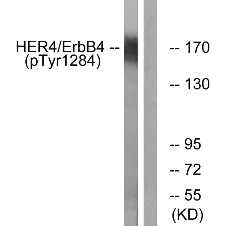 Western Blot - Anti-HER4 (phospho Tyr1284) Antibody (A0947) - Antibodies.com