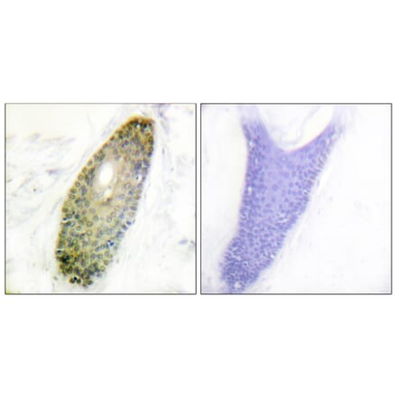 Immunohistochemistry - Anti-HDAC3 (phospho Ser424) Antibody (A0939) - Antibodies.com