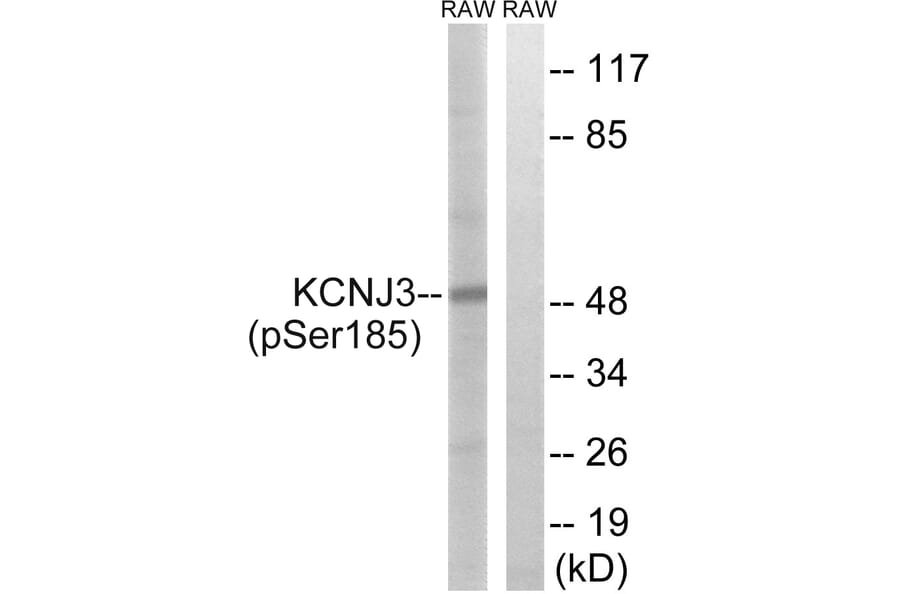 Western Blot - Anti-GIRK1 (phospho Ser185) Antibody (A1030) - Antibodies.com