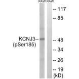 Western Blot - Anti-GIRK1 (phospho Ser185) Antibody (A1030) - Antibodies.com