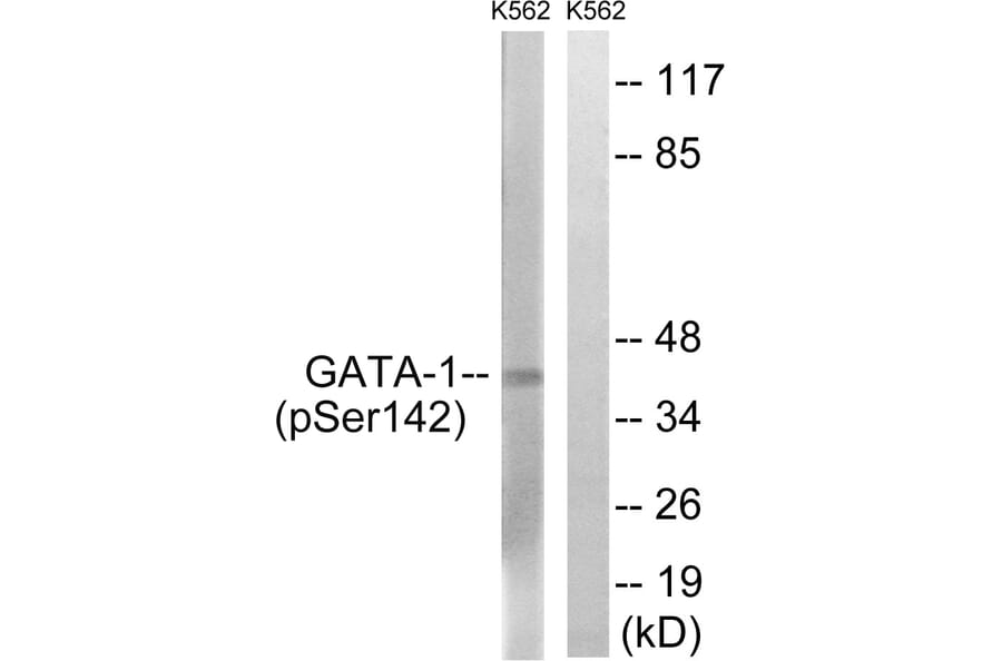 Western Blot - Anti-GATA1 (phospho Ser142) Antibody (A7092) - Antibodies.com