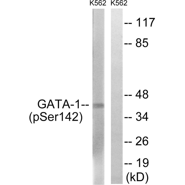 Western Blot - Anti-GATA1 (phospho Ser142) Antibody (A7092) - Antibodies.com