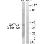 Western Blot - Anti-GATA1 (phospho Ser142) Antibody (A7092) - Antibodies.com