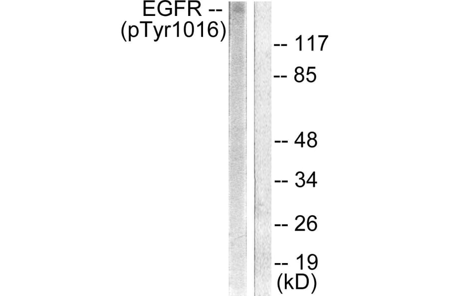 Western Blot - Anti-EGFR (phospho Tyr1016) Antibody (A0475) - Antibodies.com