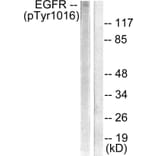 Western Blot - Anti-EGFR (phospho Tyr1016) Antibody (A0475) - Antibodies.com