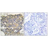 Immunohistochemistry - Anti-EGFR (phospho Tyr1016) Antibody (A0475) - Antibodies.com