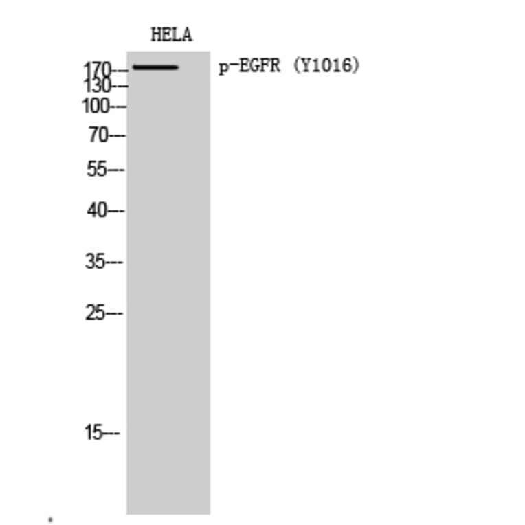 Western Blot - Anti-EGFR (phospho Tyr1016) Antibody (A0475) - Antibodies.com