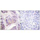Immunohistochemistry - Anti-EGFR (phospho Tyr1016) Antibody (A0475) - Antibodies.com