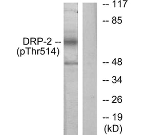 Western Blot - Anti-DRP-2 (phospho Thr514) Antibody (A1199) - Antibodies.com