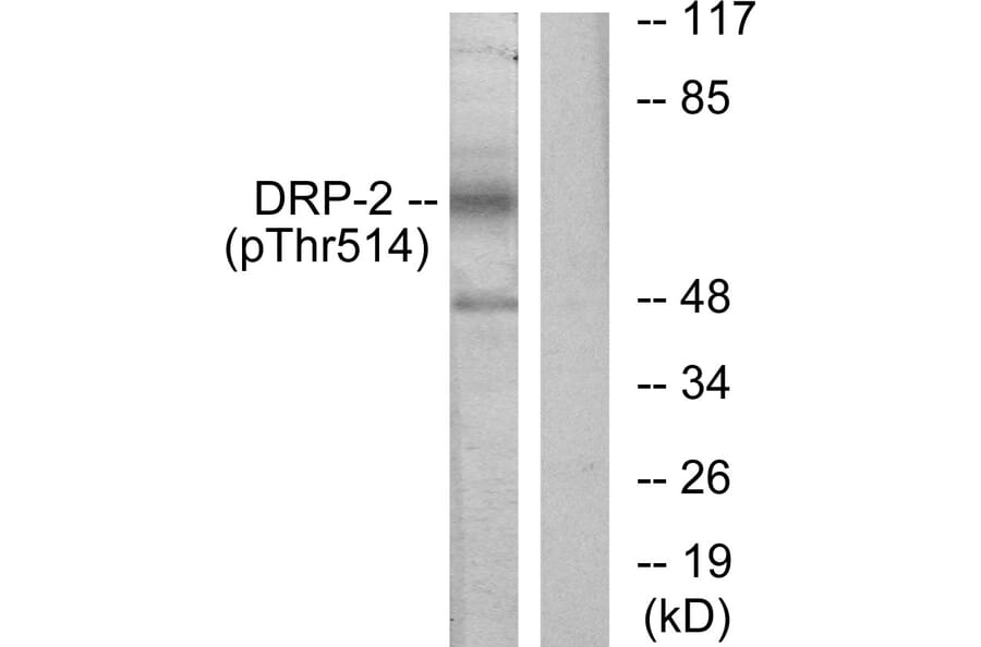 Western Blot - Anti-DRP-2 (phospho Thr514) Antibody (A1199) - Antibodies.com