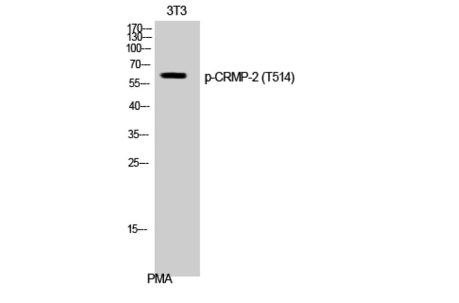 Western Blot - Anti-DRP-2 (phospho Thr514) Antibody (A1199) - Antibodies.com