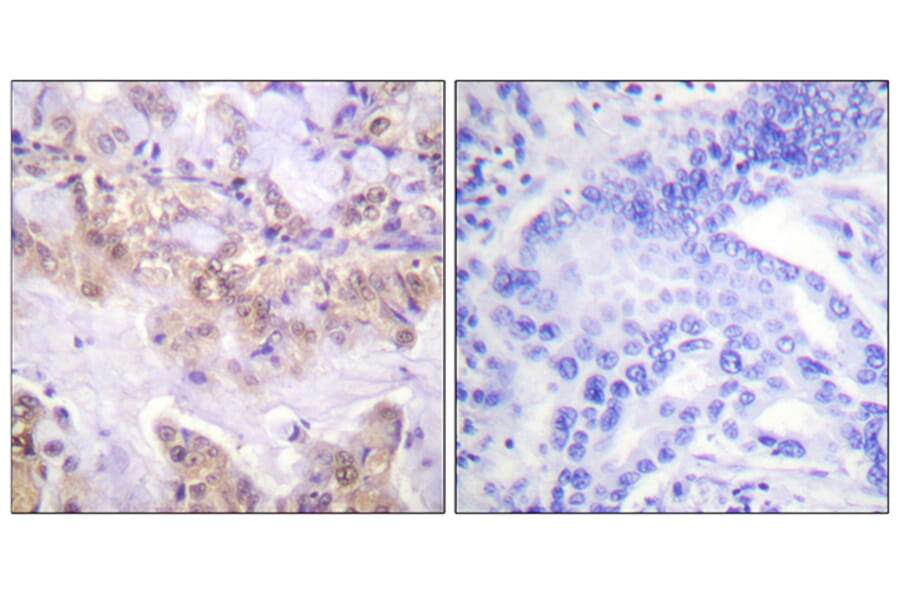 Immunohistochemistry - Anti-C-RAF (phospho Ser621) Antibody (A0566) - Antibodies.com