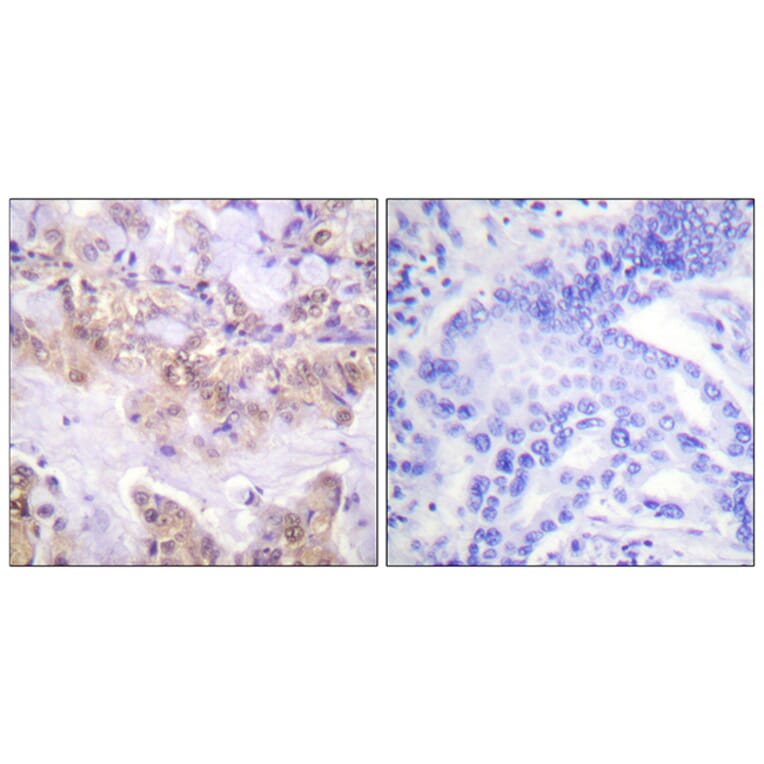 Immunohistochemistry - Anti-C-RAF (phospho Ser621) Antibody (A0566) - Antibodies.com