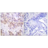 Immunohistochemistry - Anti-C-RAF (phospho Ser621) Antibody (A0566) - Antibodies.com