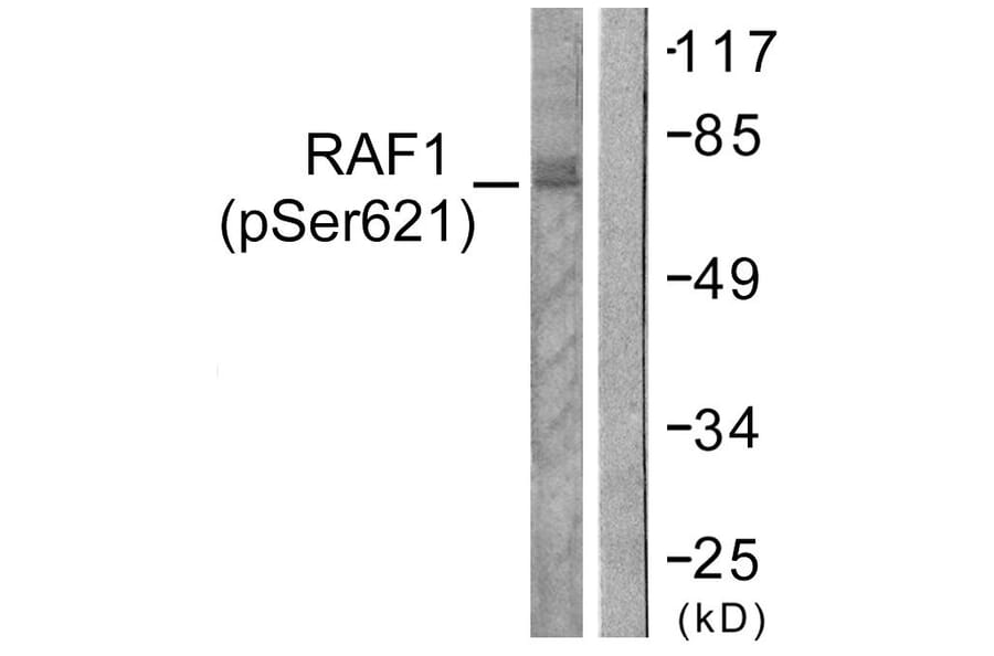 Western Blot - Anti-C-RAF (phospho Ser621) Antibody (A0566) - Antibodies.com