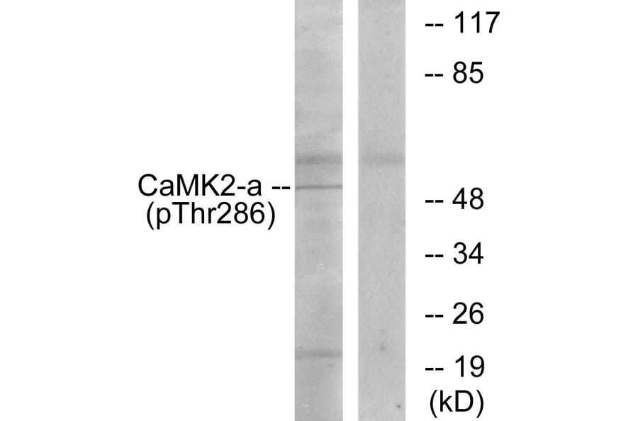 Western Blot - Anti-CaMK2 (phospho Thr286) Antibody (A7033) - Antibodies.com