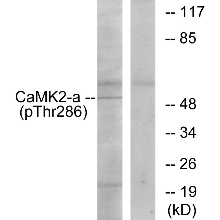 Western Blot - Anti-CaMK2 (phospho Thr286) Antibody (A7033) - Antibodies.com