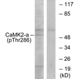 Western Blot - Anti-CaMK2 (phospho Thr286) Antibody (A7033) - Antibodies.com