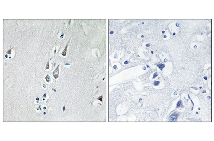 Immunohistochemistry - Anti-CaMK2 (phospho Thr286) Antibody (A7033) - Antibodies.com