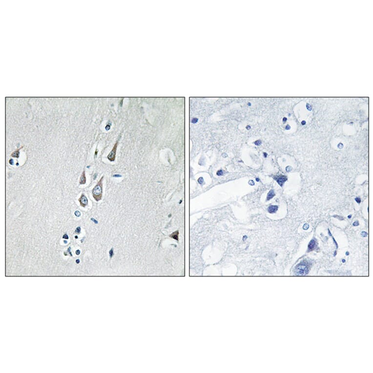 Immunohistochemistry - Anti-CaMK2 (phospho Thr286) Antibody (A7033) - Antibodies.com