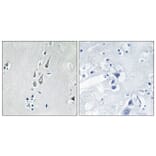 Immunohistochemistry - Anti-CaMK2 (phospho Thr286) Antibody (A7033) - Antibodies.com