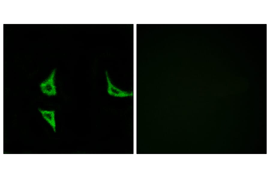 Immunofluorescence - Anti-CaMK2 (phospho Thr286) Antibody (A7033) - Antibodies.com