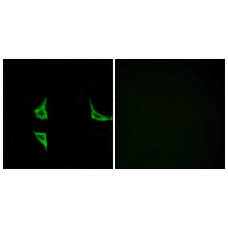 Immunofluorescence - Anti-CaMK2 (phospho Thr286) Antibody (A7033) - Antibodies.com