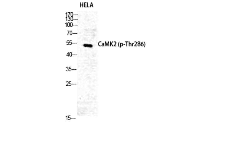 Western Blot - Anti-CaMK2 (phospho Thr286) Antibody (A7033) - Antibodies.com