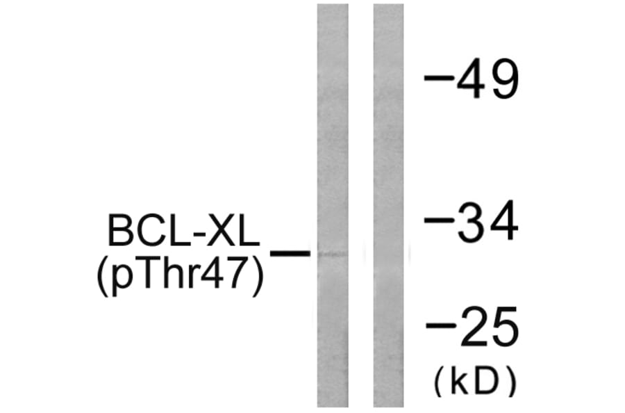 Western Blot - Anti-BCL-XL (phospho Thr47) Antibody (A0775) - Antibodies.com